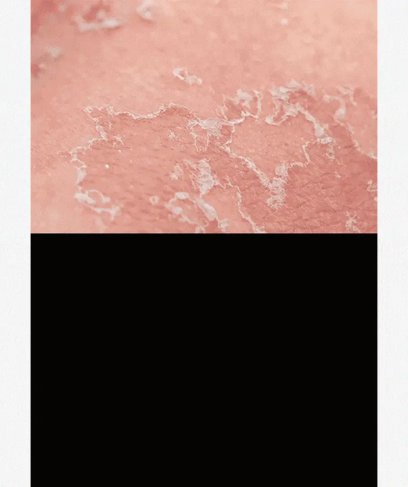 [대용량 속건조크림] 피캄 카토 크림 80ml 상세페이지 7